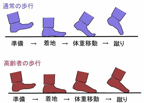 高齢者の歩行画像